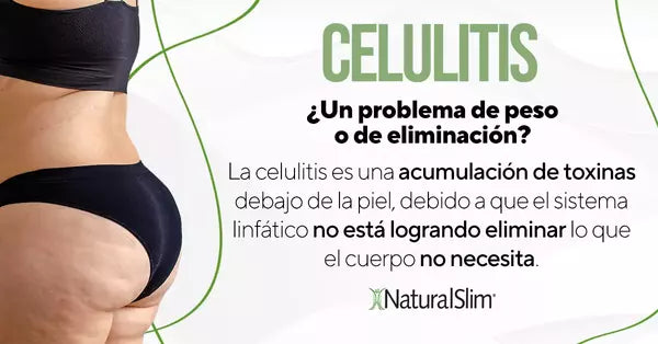 Trucos Para Eliminar y Evitar la Celulitis